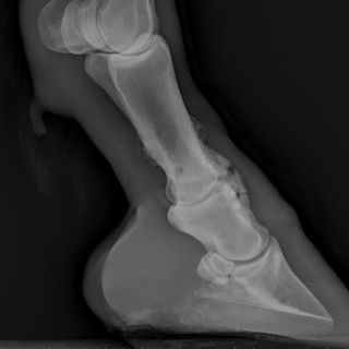 Hochgradige Arthrose am Krongelenk
