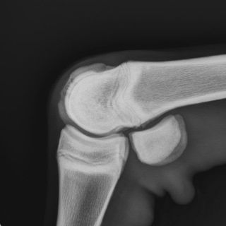 Deutliche Veränderungen am Sagittalkamm distal am Röhrbein bei einem Fohlen